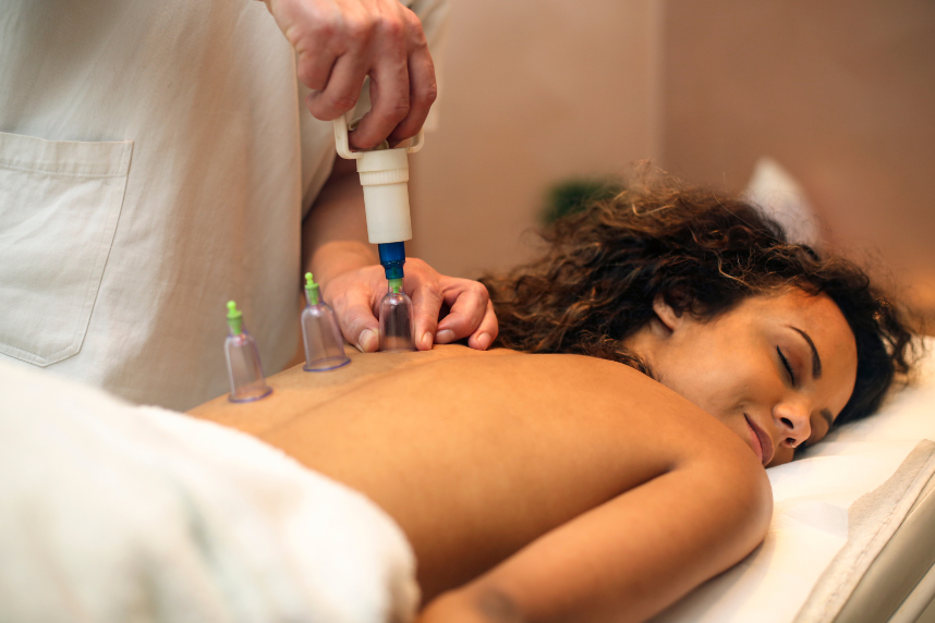 woman receiving cupping therapy